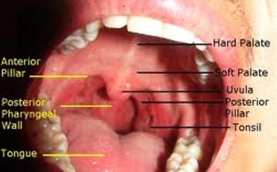 What are early signs of throat cancer?